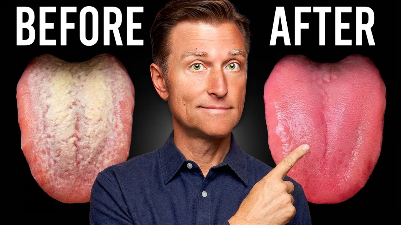 How to Get Rid of Candida in 24 Hours (And Keep It Gone)